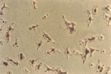 Serum-Free BAEC on standard tissue culture labware